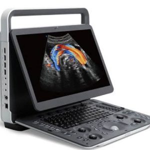 Sonoscape E2 Ultrasound Machine